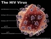 Phát hiện chủng vi-rút HIV mới “hung hăng” hơn
